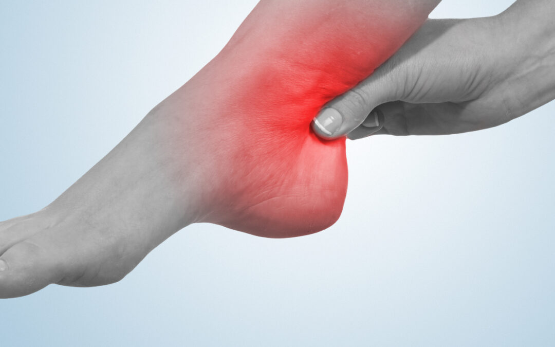 A common cause of ankle pain